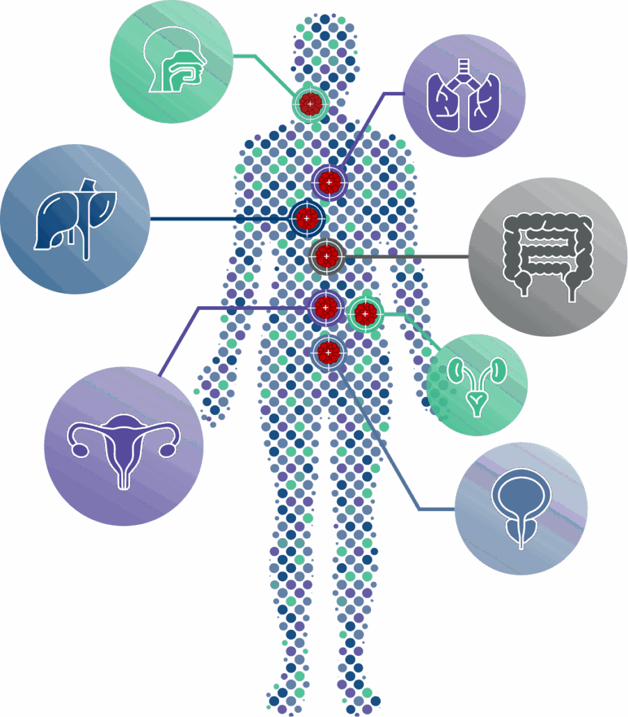 Custom patient silhouette diagram showing tumor agnostic targeting across multiple organs designed by RainCastle.